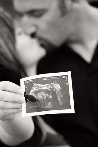 couple kissing in background with ultrasound photo