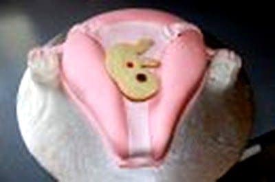 uterus cake