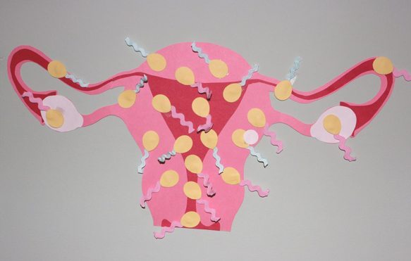pin the sperm on the uterus baby shower game