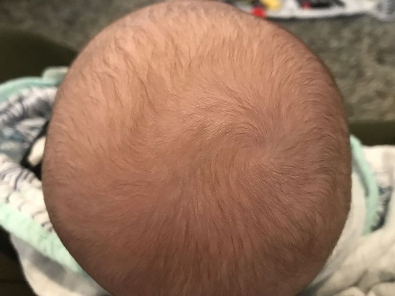 Top of newborn baby's head