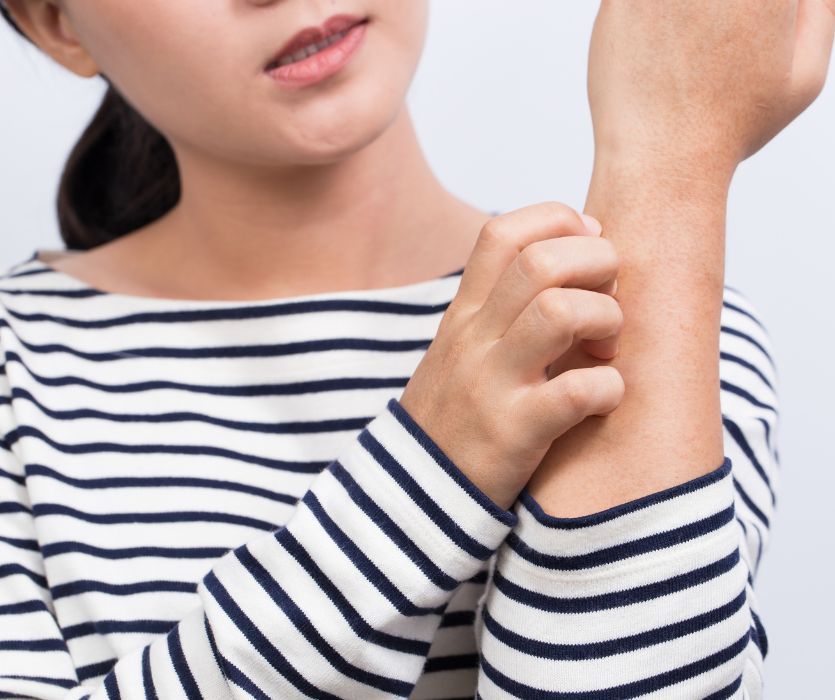 Close up of a person scratching a red, itchy rash on their forearm.