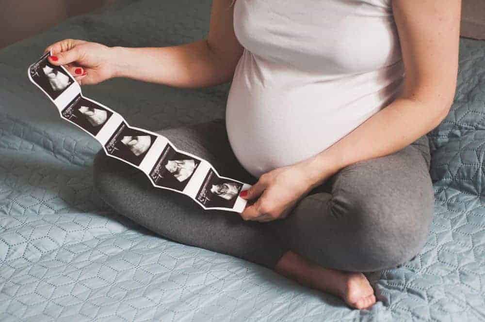 A pregnant person sitting cross-legged on a bed holding a strip of fetal ultrasound photos.