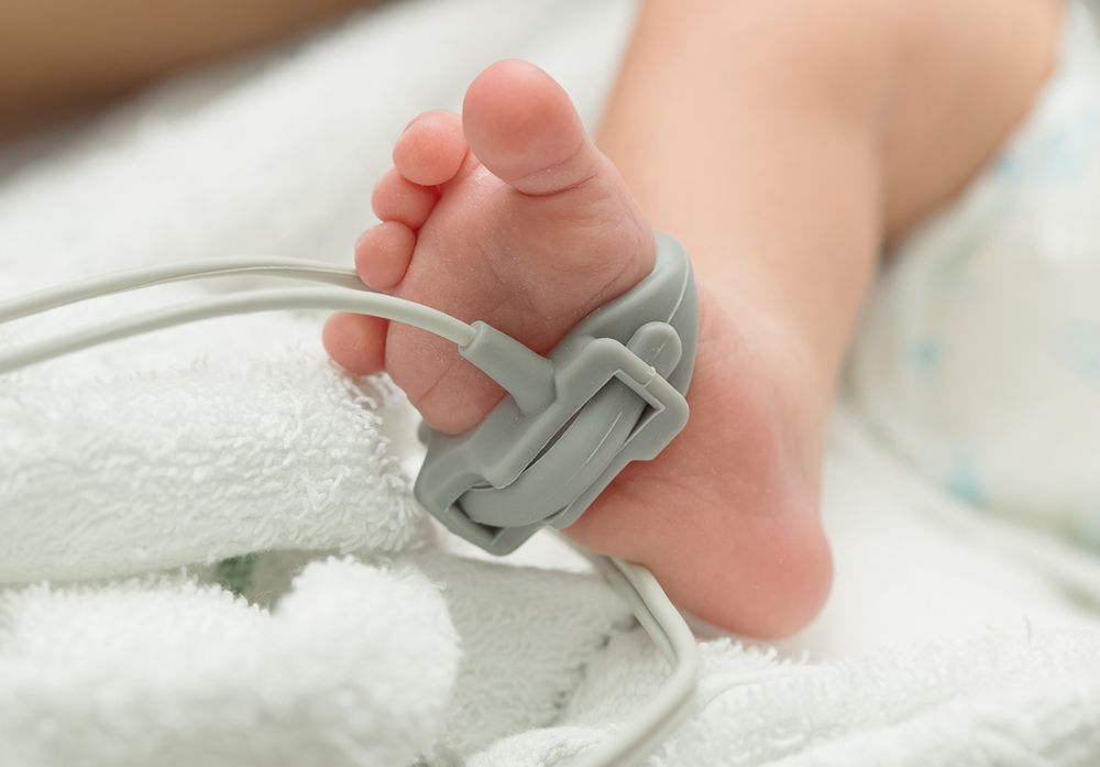 Pulse oximeter sensor attached to a newborn baby's foot in a hospital setting.