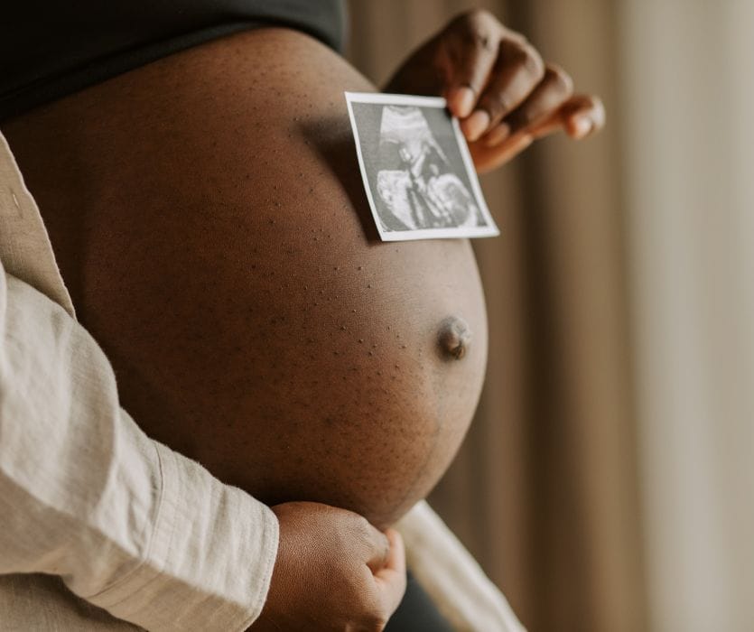 A person with dark skin holds a sonogram photo against their pregnant belly.