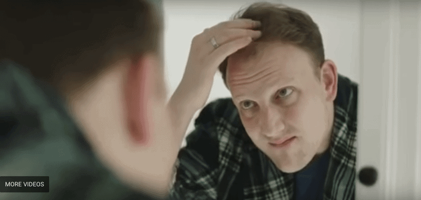 A man inspecting his receding hairline in a mirror while wearing a plaid shirt.