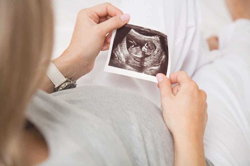A pregnant woman holds a black-and-white fetal ultrasound scan over her stomach.