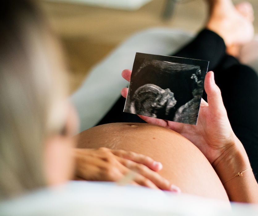 A pregnant person holds an ultrasound photo above their baby bump while lying down.