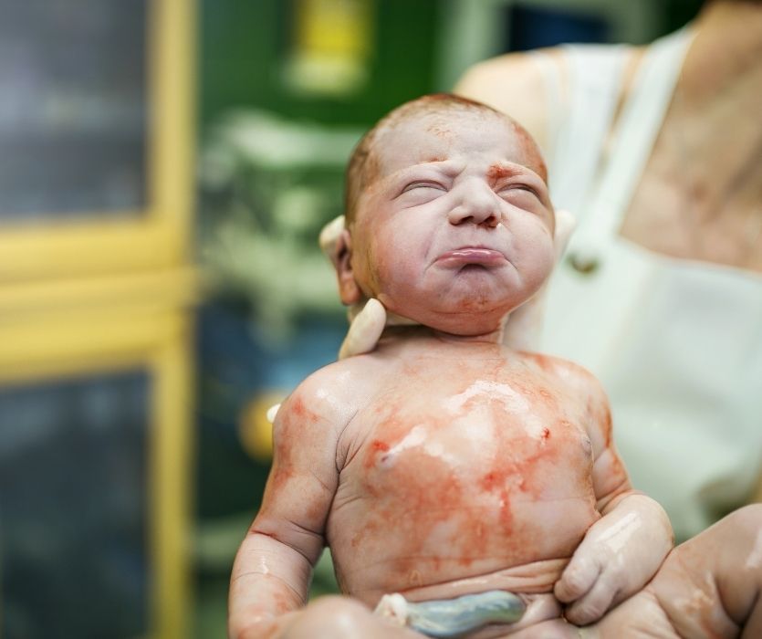 A newborn baby with eyes closed and a crying expression held by gloved hands immediately after birth.