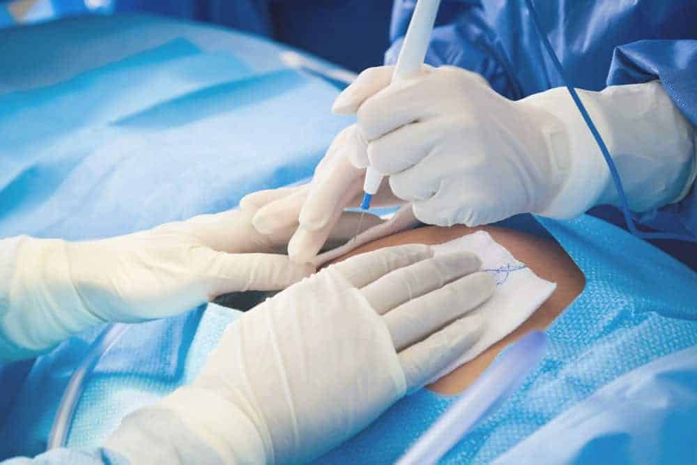 Surgeons in white gloves perform an incision on a patient's abdomen during a C-section procedure.