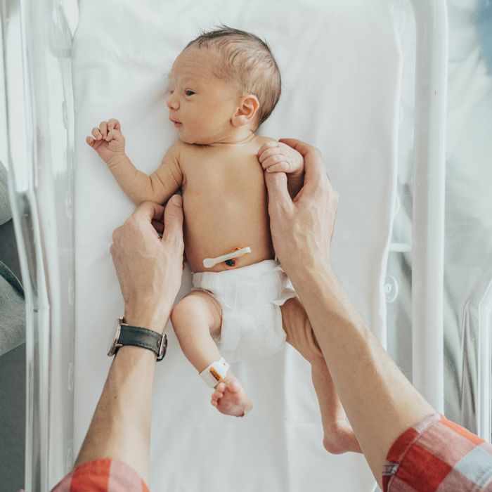 Newborn in a hospital bassinet with a plastic clamp on the umbilical cord stump.